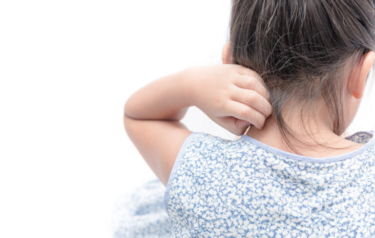 首元をかいている子ども